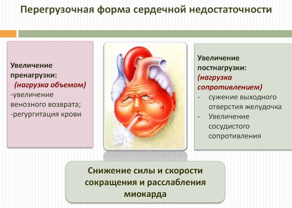 Виды сердечной недостаточности. Классификация по механизмам возникновения