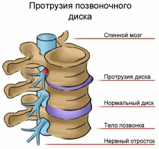 Заболевания позвоночника. Названия болезней, список, симптомы и лечение