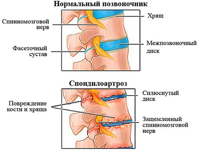 Заболевания позвоночника. Названия болезней, список, симптомы и лечение