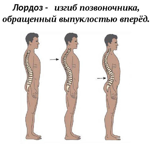 Заболевания позвоночника. Названия болезней, список, симптомы и лечение