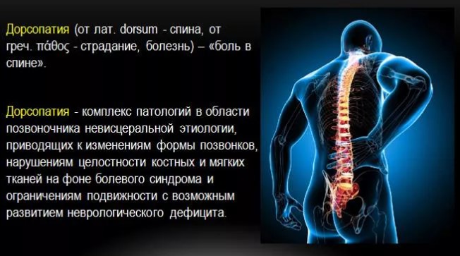 Заболевания позвоночника. Названия болезней, список, симптомы и лечение