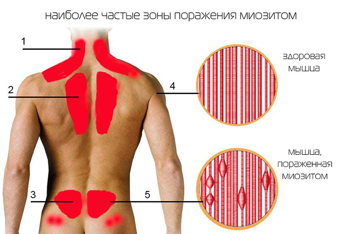 Заболевания позвоночника. Названия болезней, список, симптомы и лечение