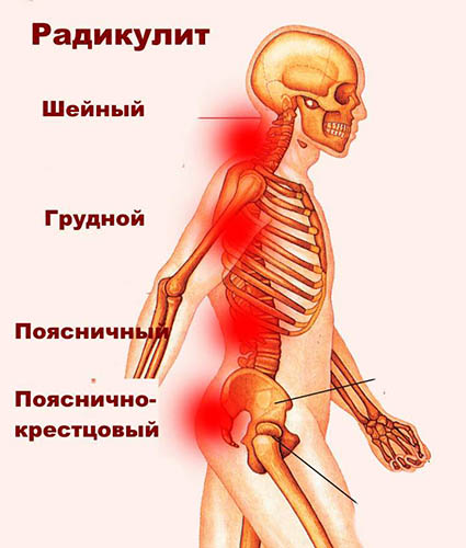 Заболевания позвоночника. Названия болезней, список, симптомы и лечение