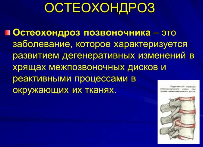 Заболевания позвоночника. Названия болезней, список, симптомы и лечение