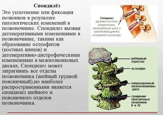 Заболевания позвоночника. Названия болезней, список, симптомы и лечение