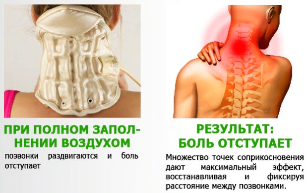 Корсеты при остеохондрозе шейный, для спины, грудного отдела, ортопедический