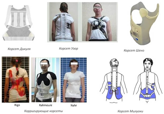 Корсеты при остеохондрозе шейный, для спины, грудного отдела, ортопедический