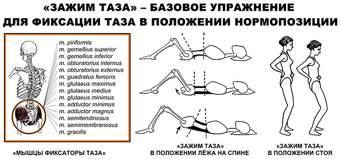 Перекос таза. Симптомы, упражнения для нормализации положения