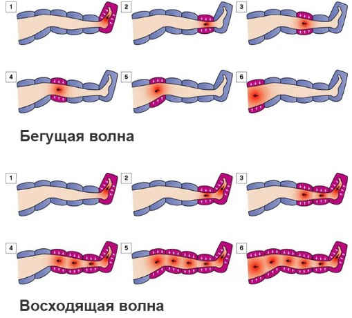 Прессотерапия. Что это такое, показания, противопоказания, побочные действия