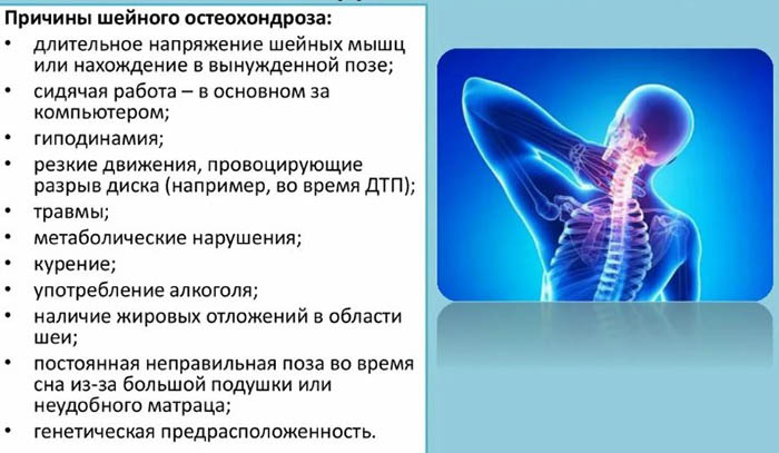 Заложенность ушей, шум в голове при шейном остеохондрозе