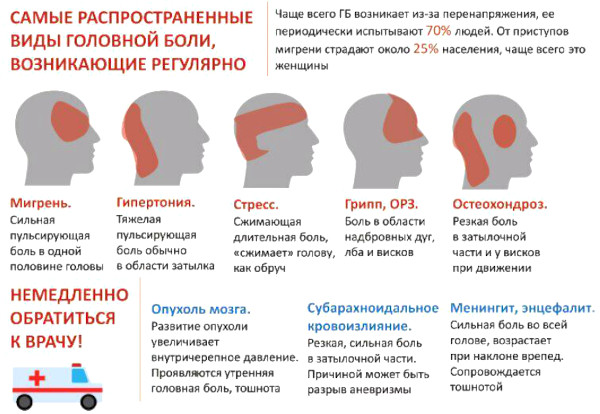 Болит голова каждый день в разных местах. Причины