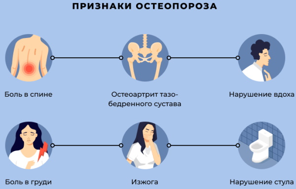 Лечение остеопороза у пожилых женщин после 60. Лечение, препараты, лекарства