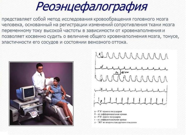 РЭГ, ЭЭГ и МРТ: чем отличаются, что это за обследование