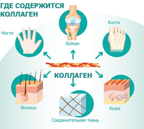 Субхондральный склероз суставных поверхностей. Что это такое