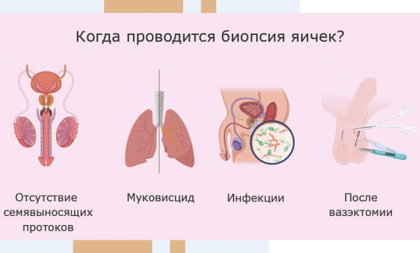 Женские гормоны у мужчины. Признаки, норма, причины и лечение