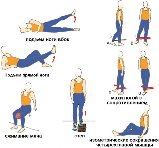 Болезнь Гоффа коленного сустава. Что это, лечение