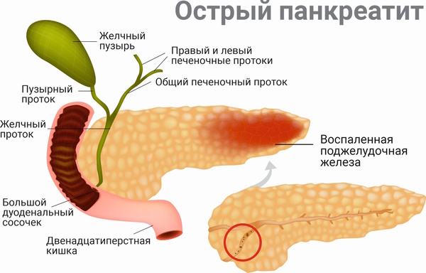 Болят ребра с двух сторон, с правой стороны при нажатии. Что делать