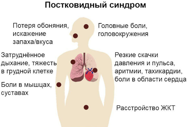 Болят суставы и мышцы после Ковида (Коронавируса). Что делать