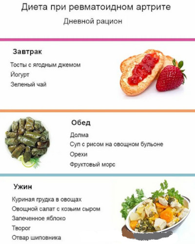 Диета при ревматоидном артрите суставов. Полезные и запрещенные продукты