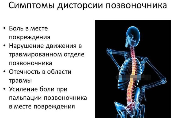 Дисторсия шейного отдела позвоночника. Что это такое, лечение