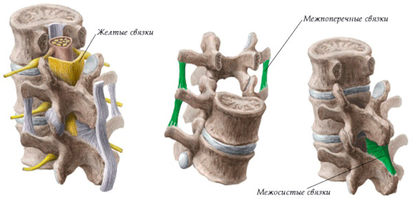 Гипертрофия желтых связок пояснично-крестцового отдела позвоночника
