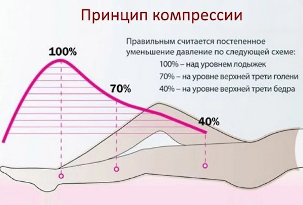 Компрессионные колготки 1-2 класс компрессии для женщин. Как выбрать