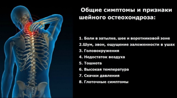 Массаж при остеохондрозе шейного отдела позвоночника. Техника выполнения