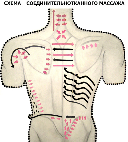 Массаж при остеохондрозе шейного отдела позвоночника. Техника выполнения