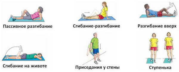 Менисцит коленного сустава. Что это, лечение