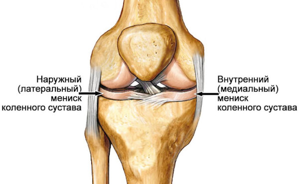 Менисцит коленного сустава. Что это, лечение