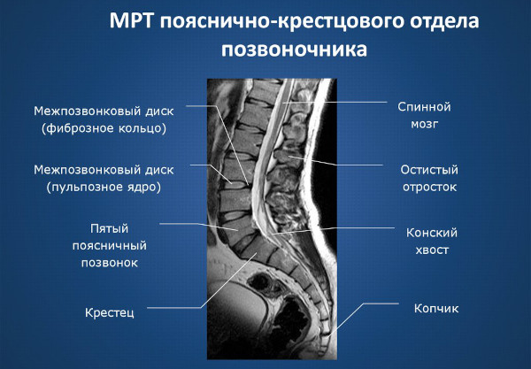 МРТ или рентген позвоночника: что лучше?