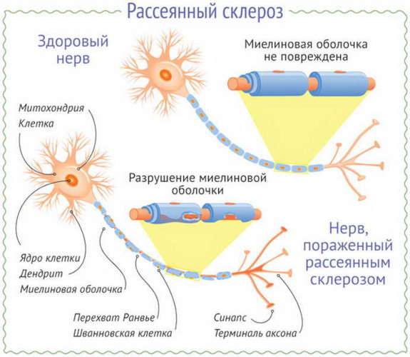 Нарушение функции тазовых органов у взрослых