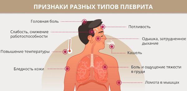 Опасность остеохондроза шейного, грудного, поясничного отдела