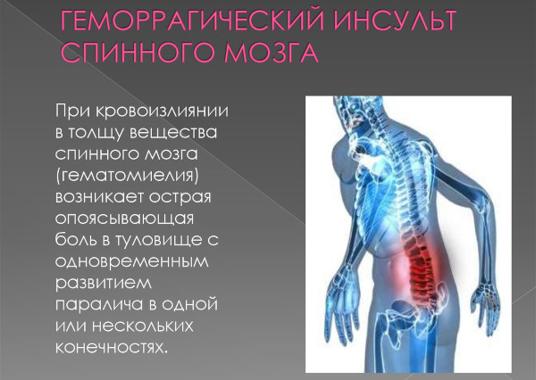 Опасность остеохондроза шейного, грудного, поясничного отдела