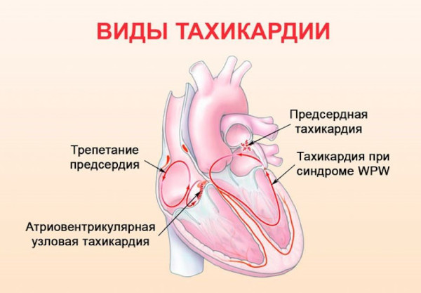 Опасность остеохондроза шейного, грудного, поясничного отдела