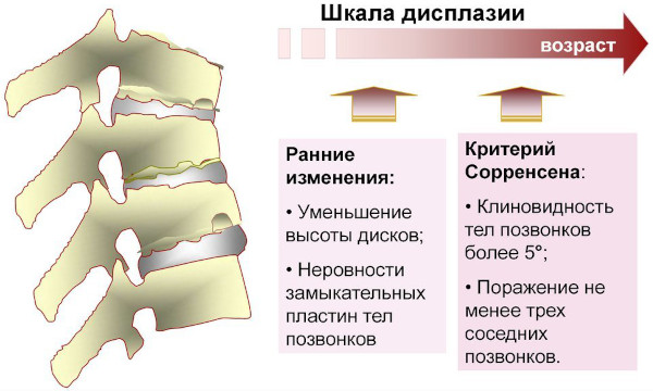 Остеохондропатия позвоночника. Что это у детей, подростка, лечение