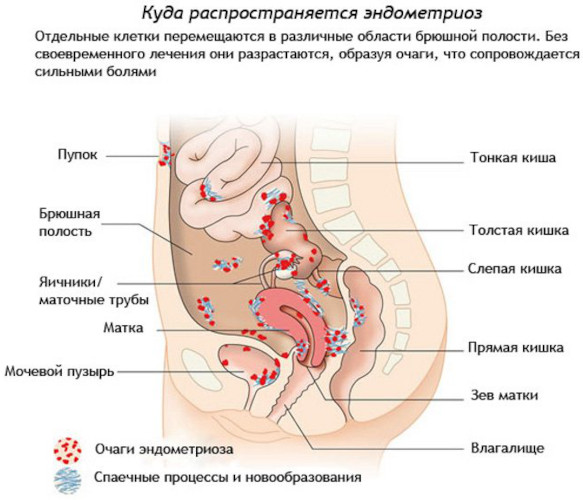 Почему больно писать в конце мочеиспускания женщине. Причины