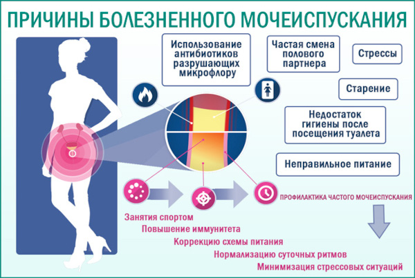 Почему больно писать в конце мочеиспускания женщине. Причины