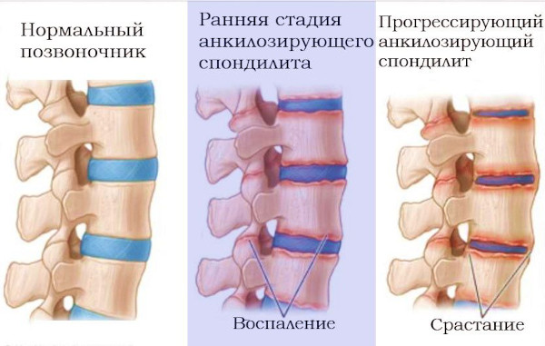 После массажа болит спина - это нормально? Почему кружится голова