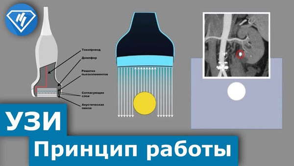 УЗИ позвоночника что показывает: поясничного отдела, шейного, пояснично-крестцового