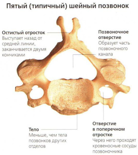 Выступающий позвонок. Выпирает позвонок на шее сзади, как убрать