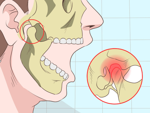 Вывих челюсти нижней, верхней. Симптомы, как вправить, что делать