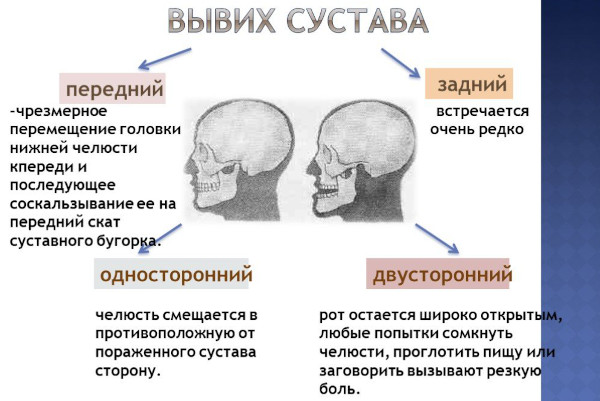 Вывих челюсти нижней, верхней. Симптомы, как вправить, что делать