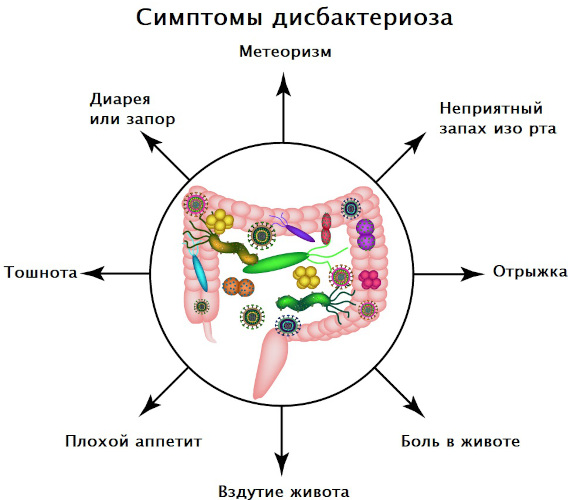 Заболевания кишечника, симптомы и признаки болезни. Список