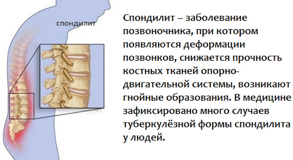 Межпозвоночные диски. Строение, анатомия, функции