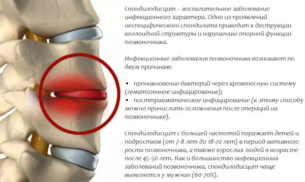 Межпозвоночные диски. Строение, анатомия, функции