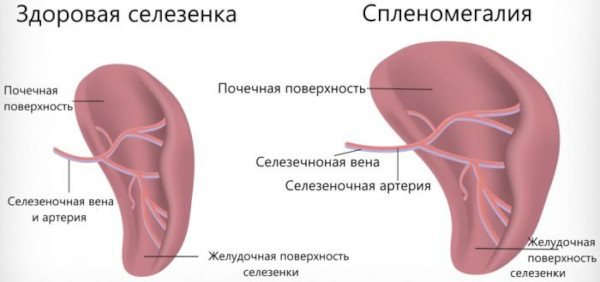 MPV (средний объем тромбоцитов) в анализе крови. Что это такое, норма