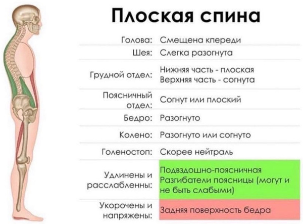 Поясничный лордоз сглажен (выпрямлен). Что это значит у взрослого, прогноз