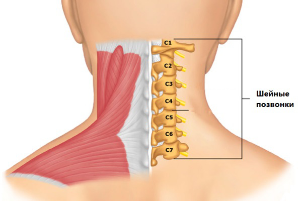 Сколиоз шейного отдела позвоночника 1 степени у взрослых. Симптомы