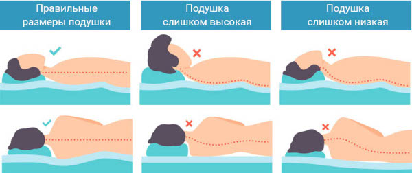 Сколиоз шейного отдела позвоночника 1 степени у взрослых. Симптомы